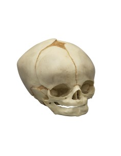 Complete kit Collection of fetal skulls from 13 weeks to...