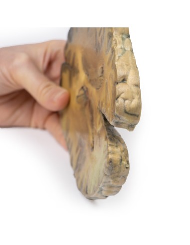 Ventriculitis secundaria a septicemia - Erler...