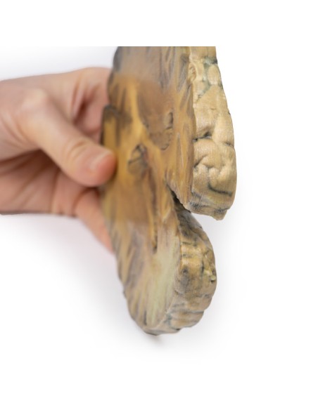 Ventrikulitis, sekundär nach Septikämie - Erler Zimmer 3D-Anatomie Serie MP2008