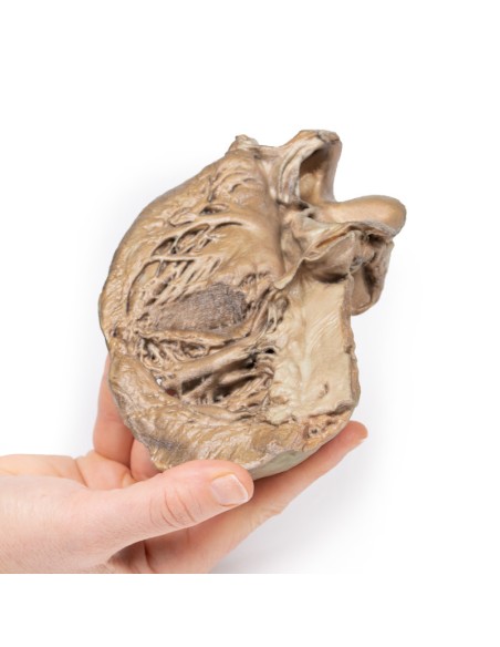 Valve aortique bicuspide - Erler Zimmer 3D anatomy Series MP2033