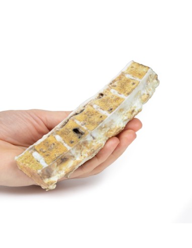 Tuberculosis - Erler Zimmer 3D anatomy Series...