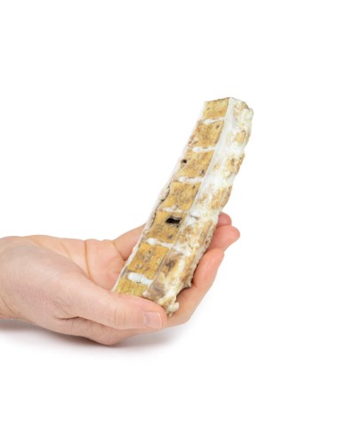 Tuberculosis - Erler Zimmer 3D anatomy Series...