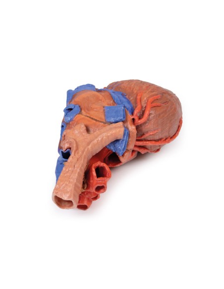 Herz und distale Luftröhre, Carina und primäre Bronchien - Erler Zimmer 3D-Anatomie Serie MP1710