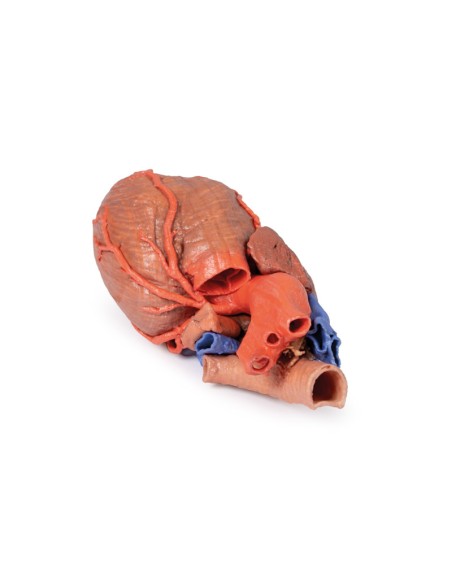 Herz und distale Luftröhre, Carina und primäre Bronchien - Erler Zimmer 3D-Anatomie Serie MP1710