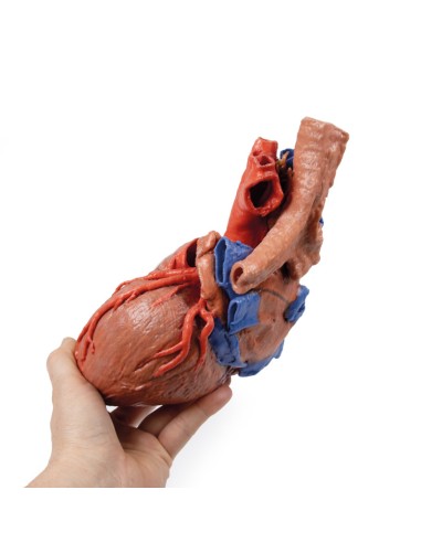 Corazón y tráquea distal, carina y bronquios...