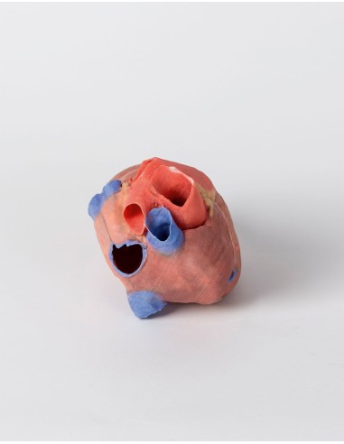 Komplettes Herz - Erler Zimmer 3D Anatomie...