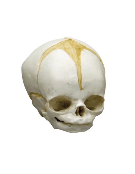 Kit completo Collezione di crani di feto da 13 settimane a 40 settimane Erler Zimmer