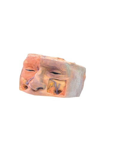 Orbite supérieure - Erler Zimmer 3D anatomy...