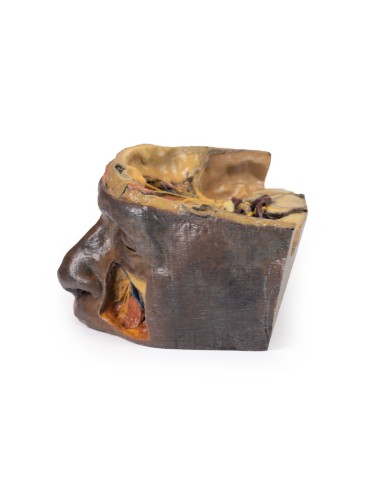 Obere Augenhöhle - Erler Zimmer 3D Anatomie...