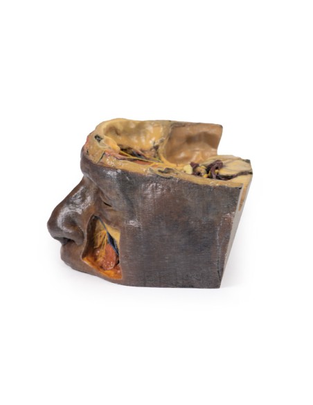 Upper Orbit - Erler Zimmer 3D anatomy Series MP1675