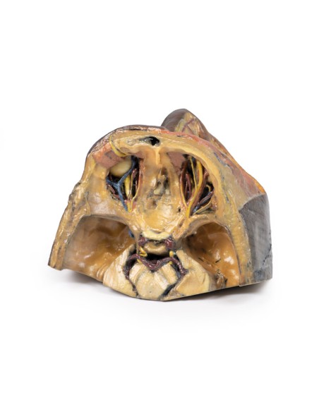 Obere Augenhöhle - Erler Zimmer 3D Anatomie Serie MP1675