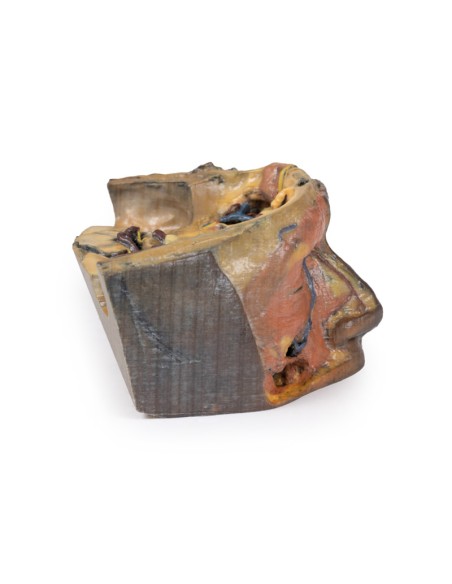 Upper Orbit - Erler Zimmer 3D anatomy Series MP1675