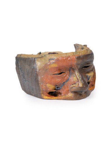 Obere Augenhöhle - Erler Zimmer 3D Anatomie...