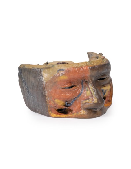 Obere Augenhöhle - Erler Zimmer 3D Anatomie Serie MP1675