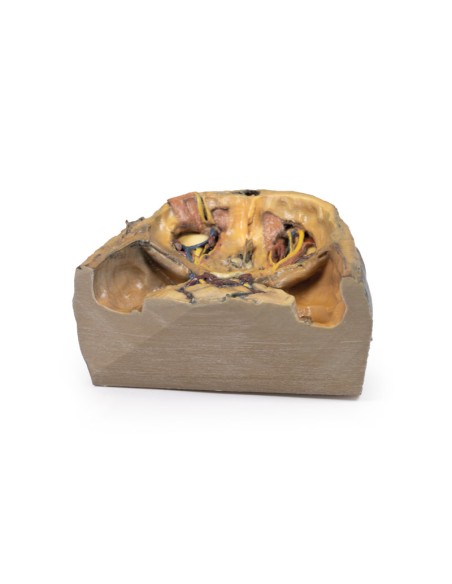 Obere Augenhöhle - Erler Zimmer 3D Anatomie Serie MP1675