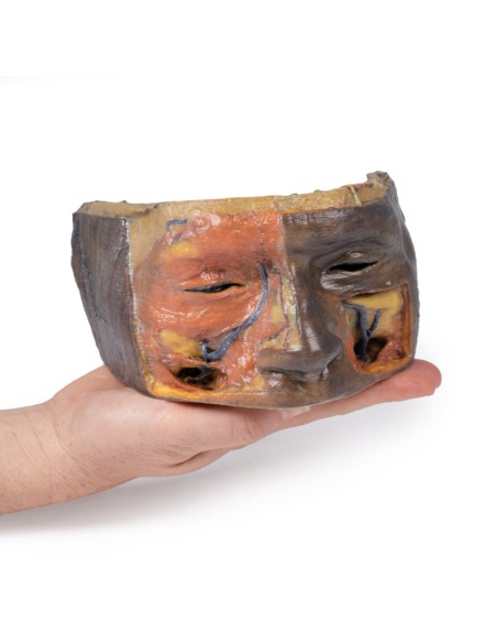 Upper Orbit - Erler Zimmer 3D anatomy Series MP1675