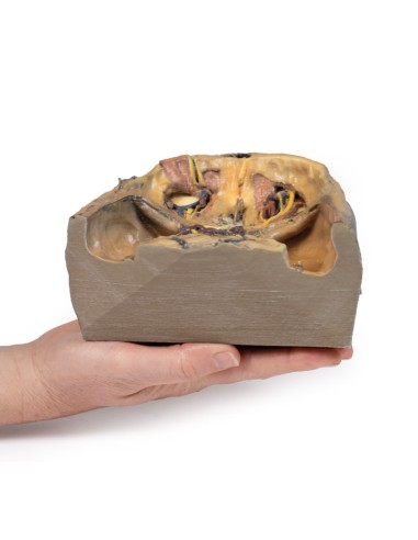 Orbite supérieure - Erler Zimmer 3D anatomy...