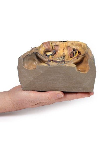 Órbita superior - Erler Zimmer 3D anatomy Series MP1675