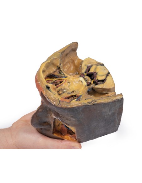 Órbita superior - Erler Zimmer 3D anatomy Series MP1675