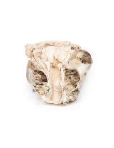 Multinodular goiter - Erler Zimmer 3D anatomy Series MP2101