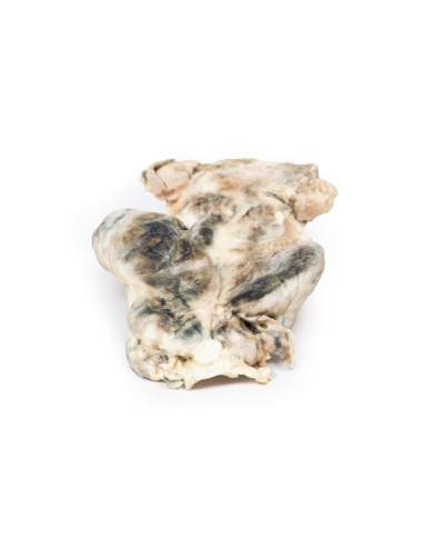 Multinoduläre Struma - Erler Zimmer 3D Anatomie...