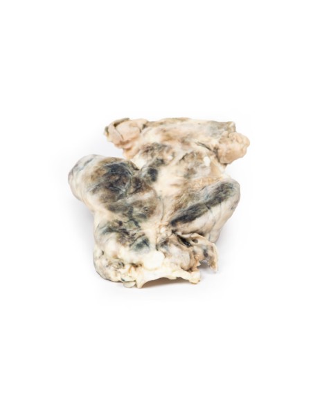 Multinodular goiter - Erler Zimmer 3D anatomy Series MP2101