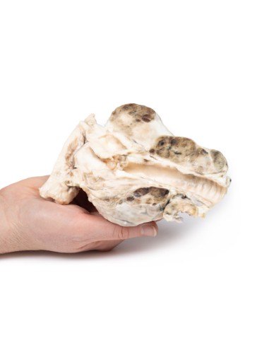 Multinoduläre Struma - Erler Zimmer 3D Anatomie...