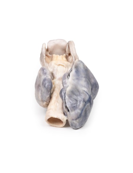 Retrosternaler Kropf - Erler Zimmer 3D-Anatomie Serie MP2102