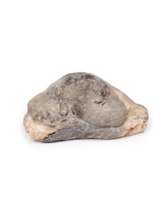 Breast Carcinoma - Erler Zimmer 3D anatomy Series MP2105