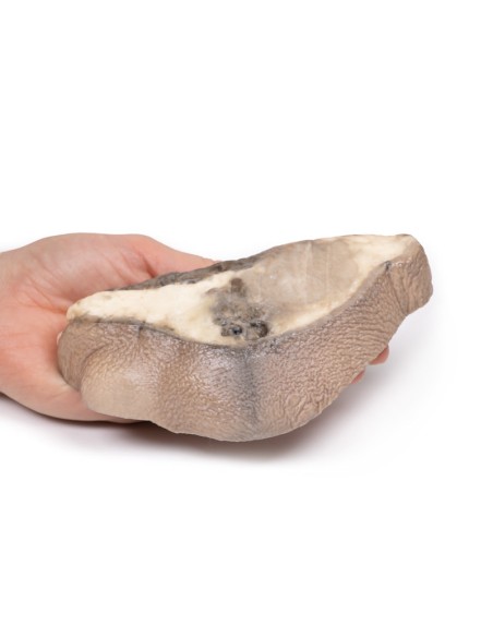 Breast Carcinoma - Erler Zimmer 3D anatomy Series MP2105