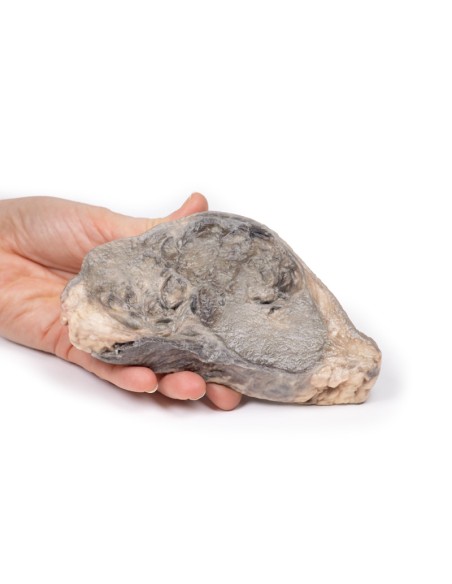 Breast Carcinoma - Erler Zimmer 3D anatomy Series MP2105