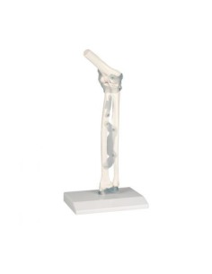 Erler Zimmer, functional model of elbow joint, with...