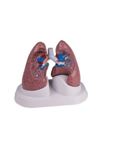 Erler Zimmer, teaching anatomical model of lungs with G52...