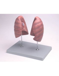 Erler Zimmer, teaching anatomical model of lungs, right...