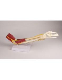 Erler Zimmer, functional anatomical model of elbow joint,...