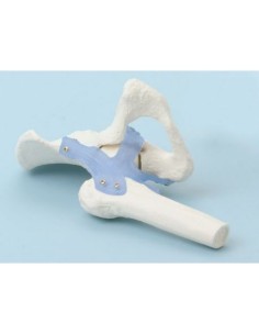 Erler Zimmer, functional anatomical model of hip joint,...