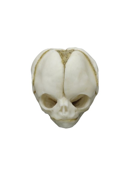 Kit completo Collezione di crani di feto da 13 settimane a 40 settimane Erler Zimmer