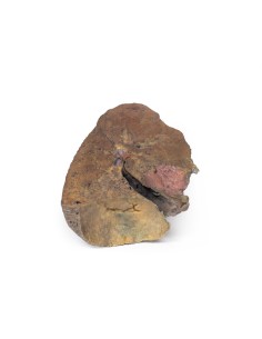 Coupe de poumon, hile enlevé - Erler Zimmer 3D anatomy...