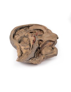 Parasagittaler Schnitt des Kopfes und des Halses - Erler...