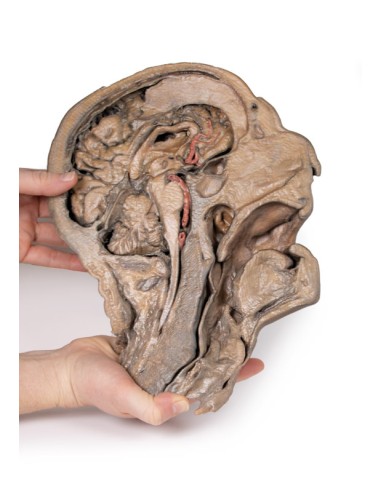 Parasagittal section of the head and neck -...
