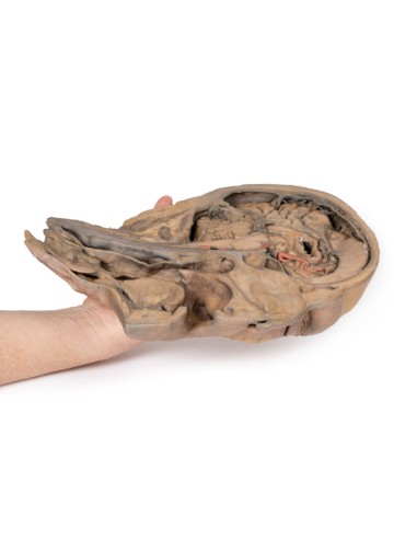 Parasagittal section of the head and neck -...