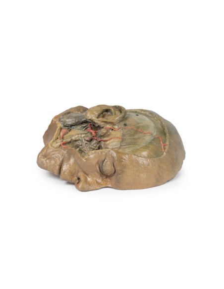 Sagittal section of the head with infratemporal fossa dissection - Erler Zimmer 3D anatomy Series MP1104