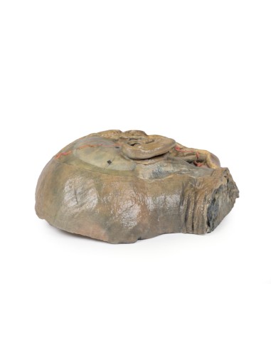 Sagittal section of the head with infratemporal...