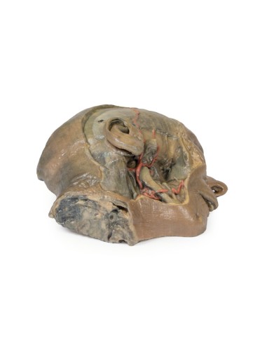 Sagittal section of the head with infratemporal...