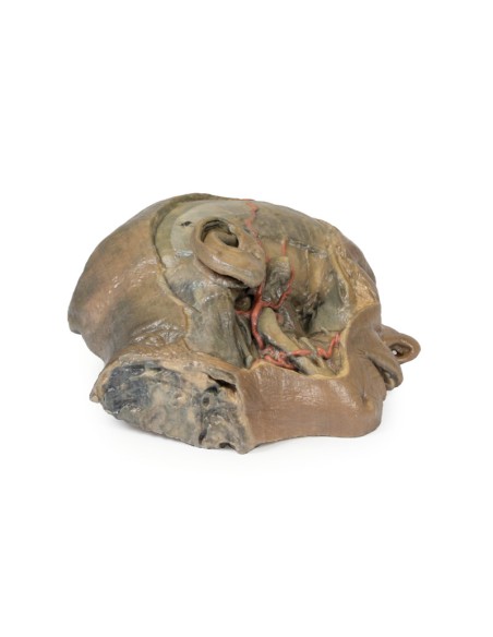 Coupe sagittale de la tête avec dissection de la fosse infratemporale - Erler Zimmer 3D anatomy Series MP1104