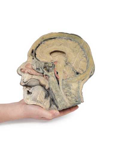 Sagittal section of the head with infratemporal...