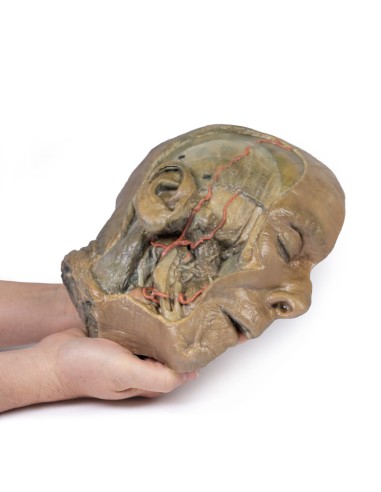 Sagittal section of the head with infratemporal...