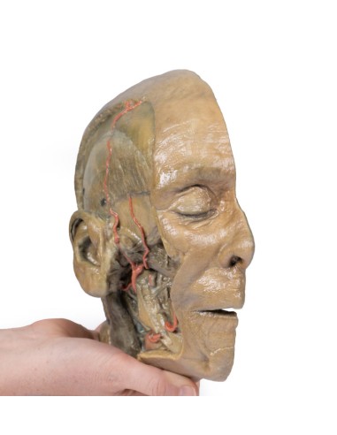 Coupe sagittale de la tête avec dissection de...