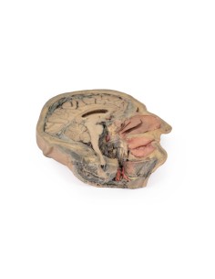 Sagittal section of the head with deep dissection - Erler...