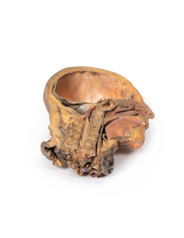 Sagittal section of head and neck with...